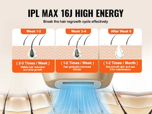 VEVOR ipl hair removal device demonstrating hair reduction process over weeks.