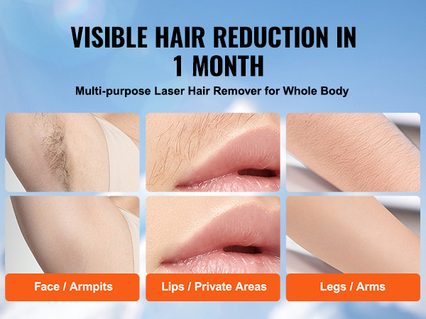 visible hair reduction in 1 month with VEVOR ipl hair removal for face, lips, legs, and armpits.
